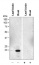 TIP2;1 | tonoplast intrinistic protein 2-1
